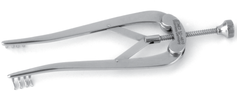 ALM Retractor