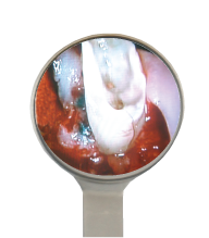 HD Rhodium Mouth Mirror Size 4