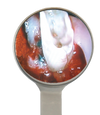 HD Rhodium Mouth Mirror Size 5