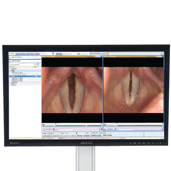 Endoscope monitor screen - D-SCOPE VIA