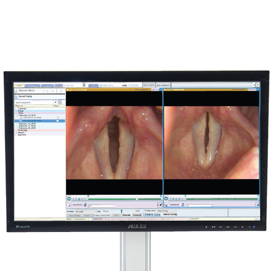 Endoscope monitor screen - D-SCOPE VIA