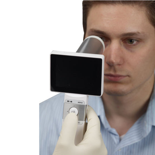 40° Manual Focus Portable Fundus Camera Checkp