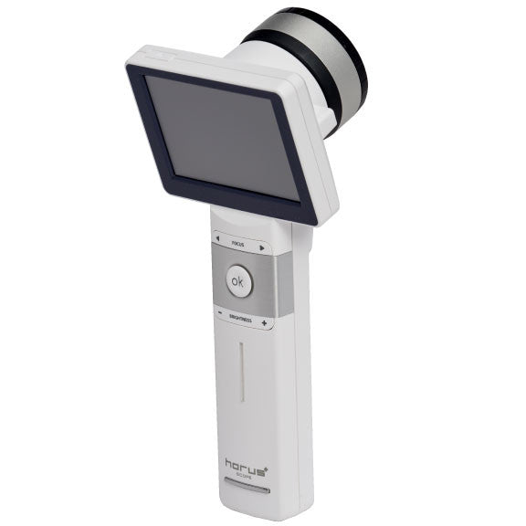 Surface Lens - Series 2 & 3 Handle Only