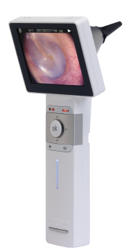 HD Video Otoscope - JEDMED