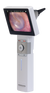 HD Video Otoscope