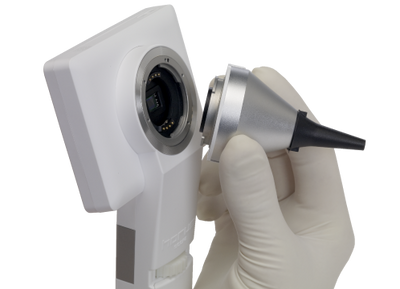 Horus HD Digital Scope System - Series 1