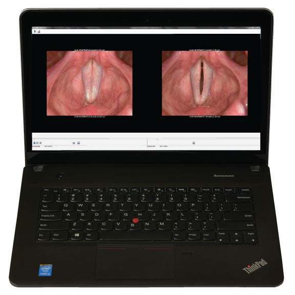 PHAZR Portable Stroboscopy Full View