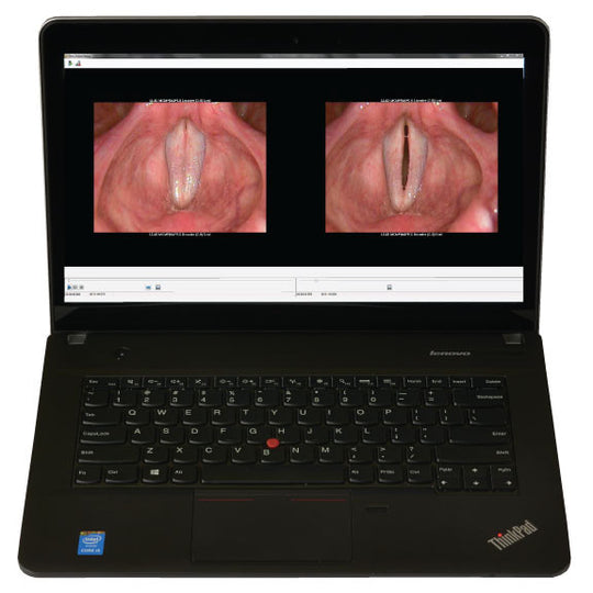 PHAZR Portable Stroboscopy Laptop View