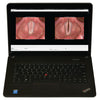 PHAZR Portable Stroboscopy