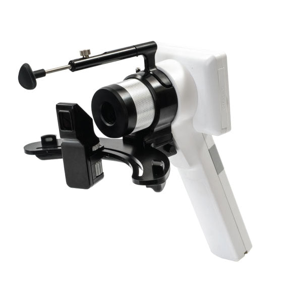 Anterior View Attachment Side View